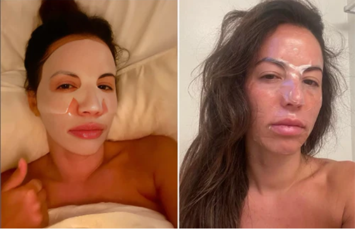 BiocollagenPlus  Máscara absorvível de colágeno + ativos do botox.