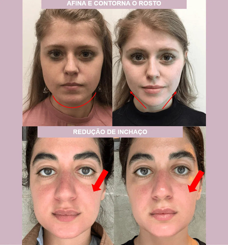 V-Revitalize™ - Máscara de Contorno Facial - Suaviza Rugas, Papada e Modela o Rosto